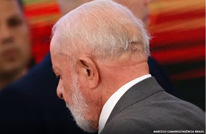 Imagem de Lula é operado às pressas após sentir forte dor de cabeça