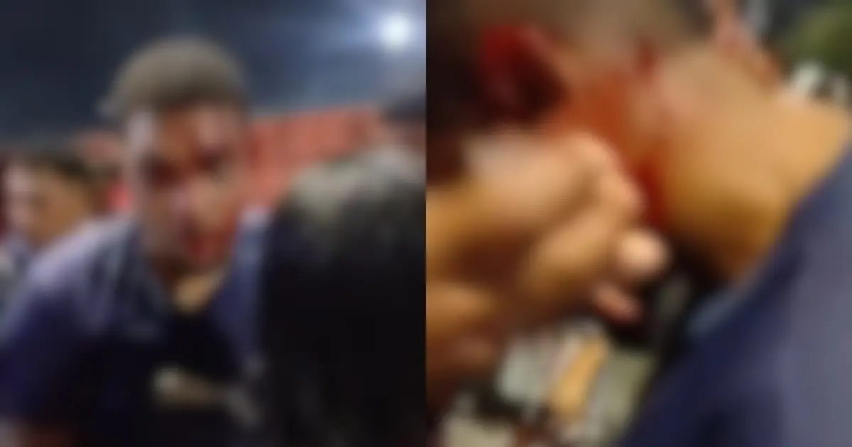 Imagem de Motociclista é agredido durante confusão após Vitória x Vasco no Barradão