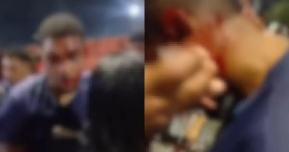 Imagem de Motociclista é agredido durante confusão após Vitória x Vasco no Barradão