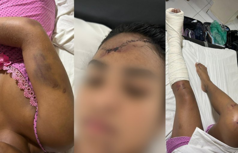 Imagem de Mulher que caiu de prédio na Paralela faz vaquinha para conseguir voltar para casa