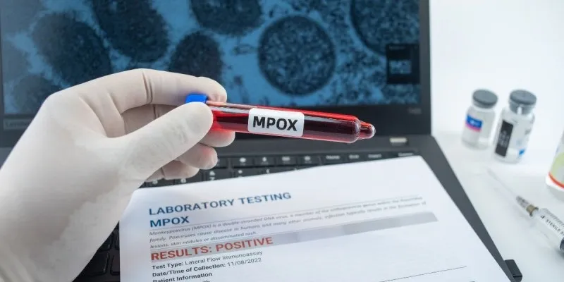 Imagem de Casos de Mpox no Brasil sobem para 140 em 2026, aponta Ministério da Saúde