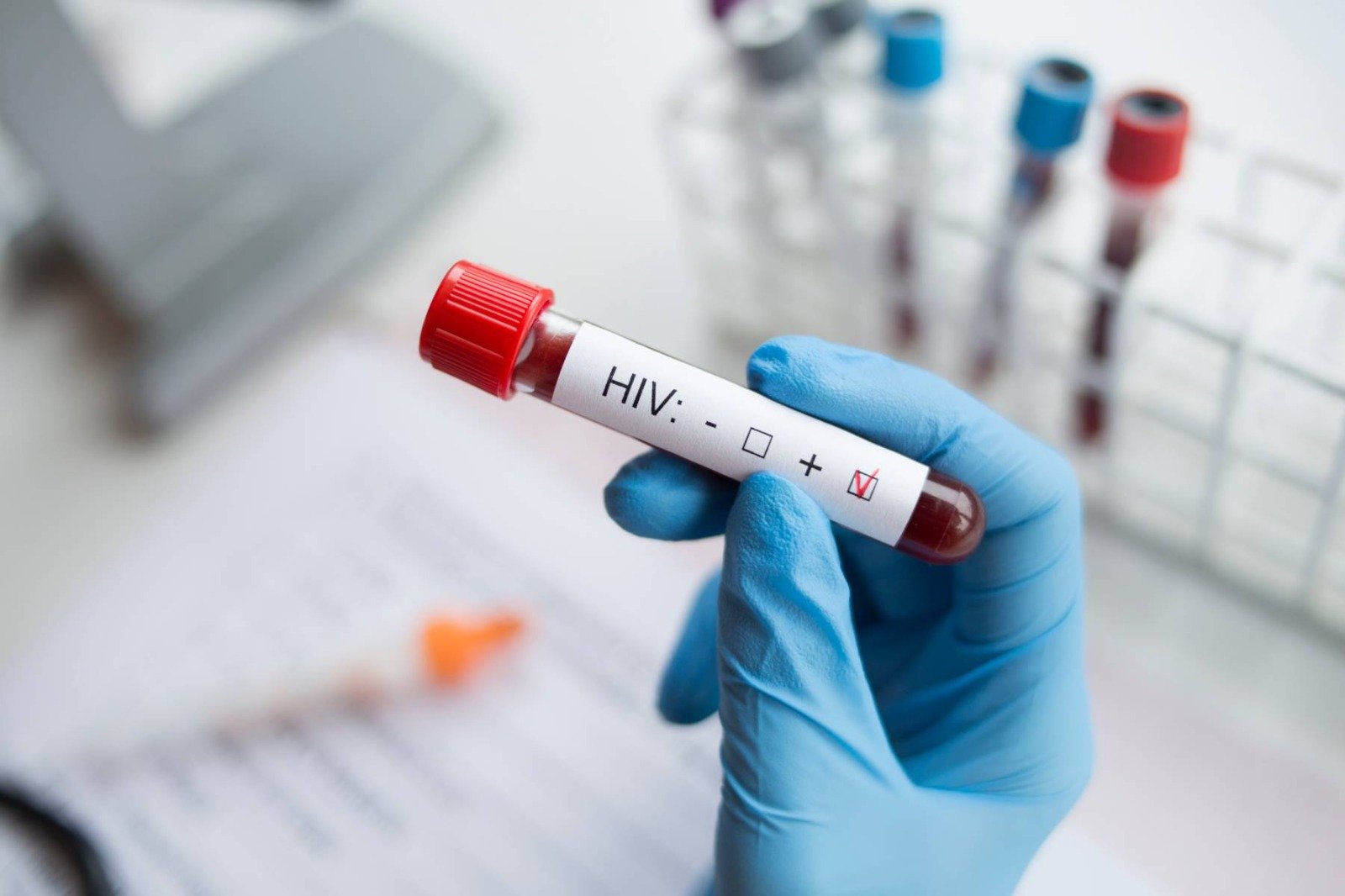 Imagem de Dia Mundial de Combate à AIDS: mais de 2.304 casos de HIV são registrados na Bahia