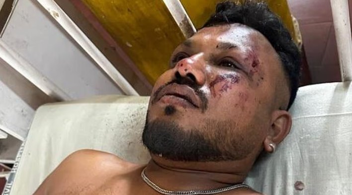 Imagem de Veja o que disse o britânico que sobreviveu ao acidente aéreo da Air India que matou centenas